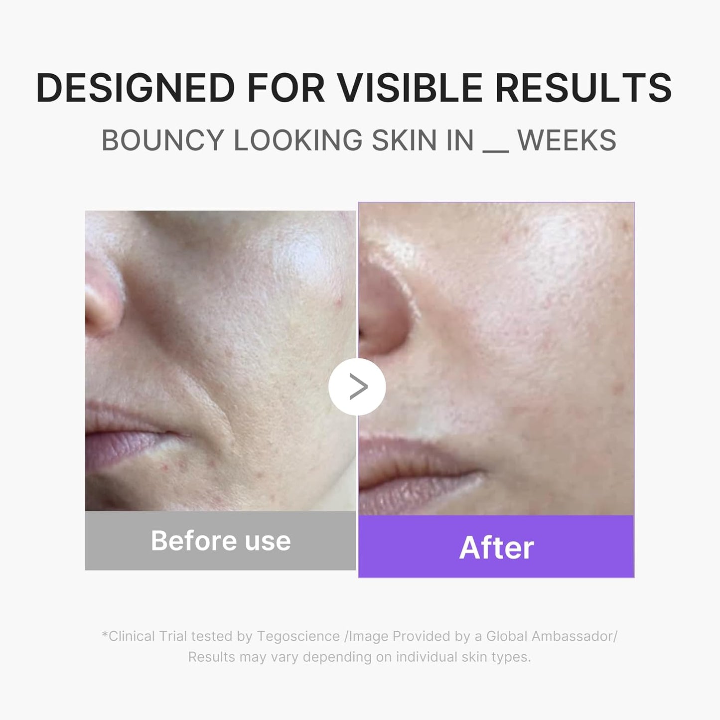 Glow & Go Facial Device Kit