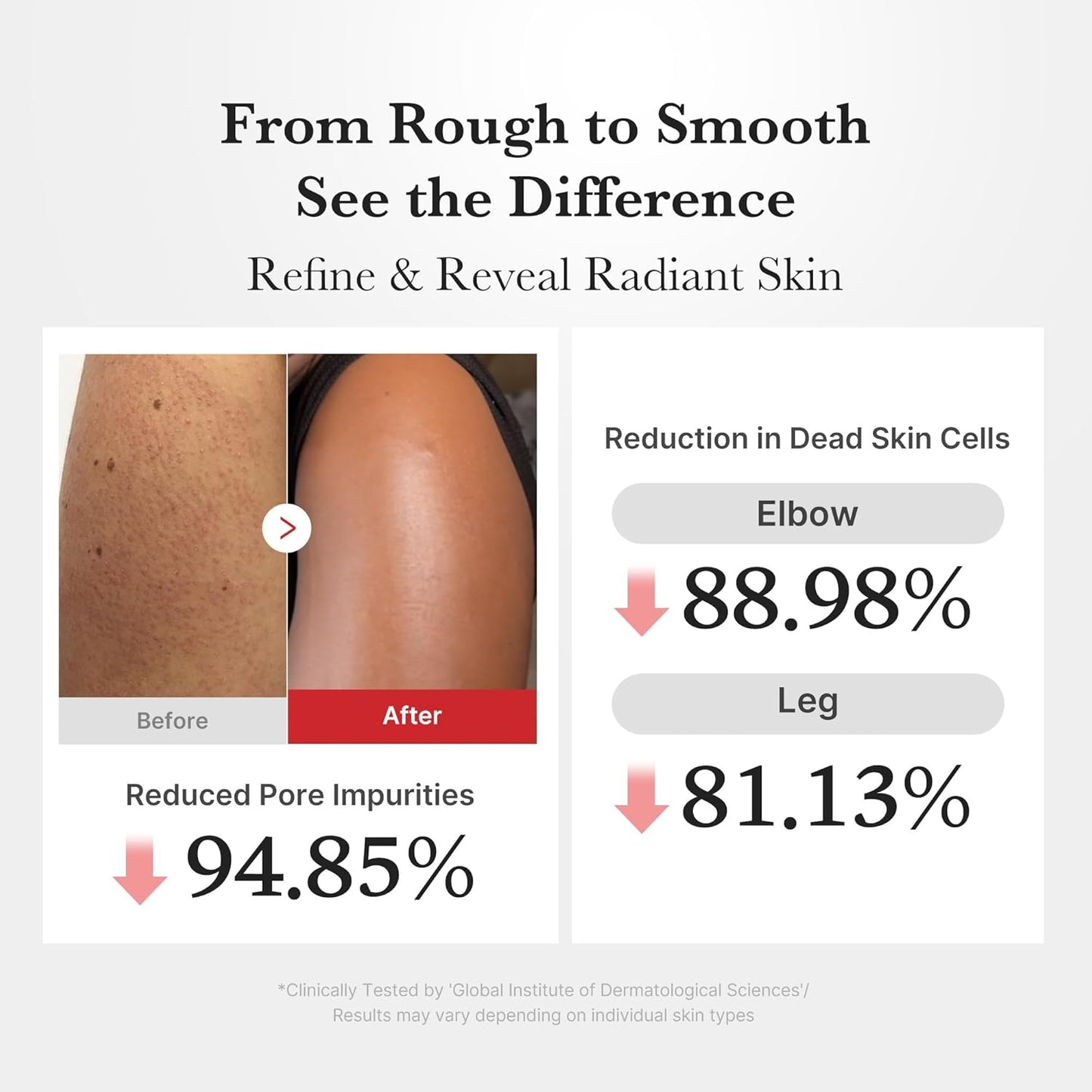 Gentle Skin Renewal Serum