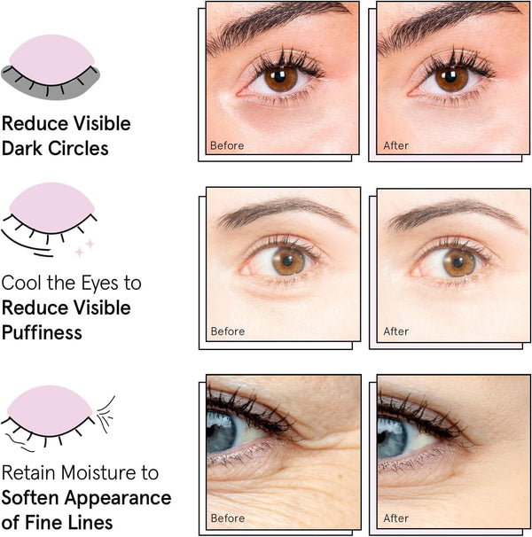 Glow & Refresh Eye Masks
