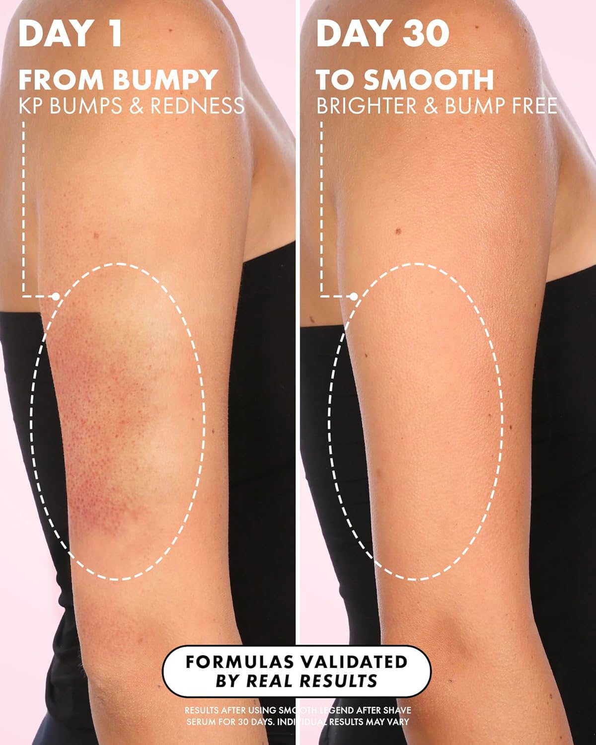 Smooth Skin After Shave Serum
