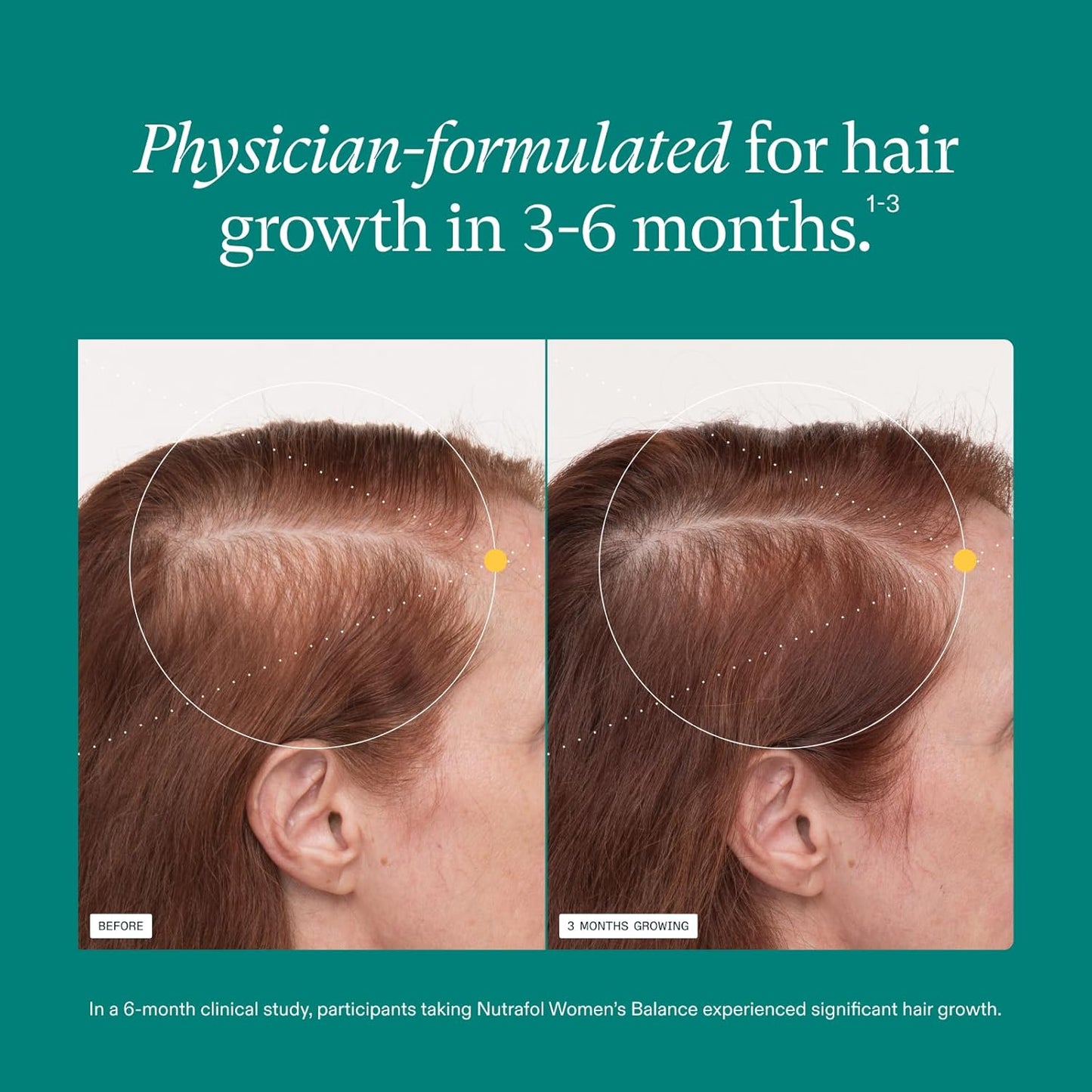 Thicker Hair Growth Capsules