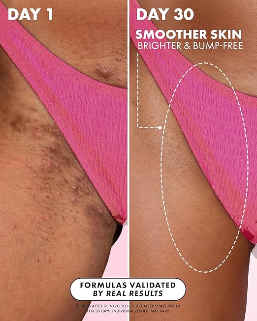 Smooth Skin After Shave Serum