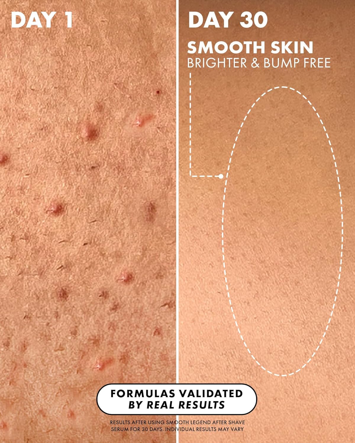 Smooth Skin After Shave Serum